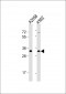 OR8J3 Antibody (C-term)