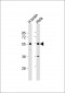 TFG Antibody (Center)