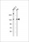 BARON Antibody (Center)