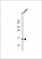 HIST1H2BA Antibody (N-term)