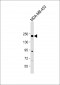 ERBB2 Antibody (C-term Y1127)