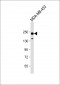 ERBB2 Antibody (C-term S1054)