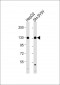 RENT1 Antibody (N-term E22)