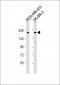 ERBB2 Antibody (Center S998)