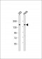 AMOT Antibody (Center S305)