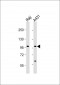 NFKB1 Antibody (S932)