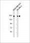 ERBB2 Antibody (C-term S1050/S1051)