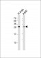 ASCL1 (Achaete-scute homolog 1) Antibody (C-term D220)