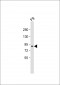 SUZ12 Antibody (C-term)