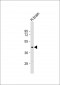 MTCH1 Antibody (Center)