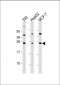 CDKN1A Antibody (C-term)