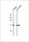 MAP1LC3A Antibody (C-term)