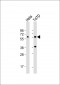 USP21 Antibody (N-term P31)