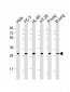 RPS4X Antibody (C-Term)