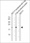 S1 tag  Antibody