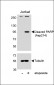 Cleaved PARP (Asp214) Antibody
