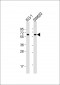 CHRM3 Antibody (Center)