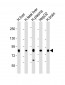 Transferrin Antibody