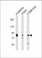 Transferrin Antibody