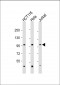 MANBA Antibody (C-Term)