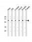 SLC2A8 Antibody (Center)