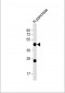 NPTX2 Antibody (C-term)