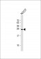 LIN28A Antibody (C-term)