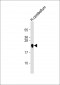 MBP Antibody (Y203)