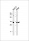 SFRS2 Antibody (N-term)