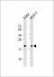 APRT Antibody (C-term)