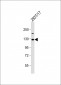 VLDLR Antibody (Center)