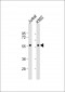 MEF2C Antibody (S396)