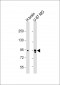 Synphilin-1 (SNCAIP) Antibody (C-term)