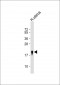 TAGLN Antibody (N-term)