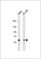 MTM1 Antibody (C-term)