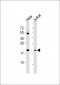 SMAC Antibody (C-term)