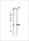 FTH1 Antibody (C-term)