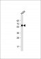 PKM2 Antibody (C-term L398)