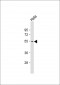 PRAK (MAPKAPK5) Antibody (T182)