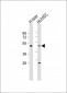 SPHK1 Antibody (Center)