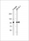 STK31 Antibody (C-term)