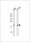 FRIH Antibody (C-term)