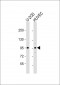 GIT1 Antibody (Center)