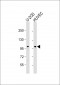 GIT1 (Y554) Antibody (C-term)