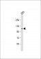 KIT Antibody (Y721)