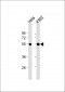IRAK4 Antibody (N-term)