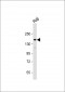 ASK1 (MEKK5/MAP3K5) Antibody (S1033)