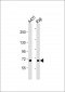 MAP3K5 Antibody(T842)