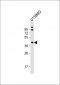 Endophilin B1 Antibody (Y80)