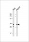IMP4 Antibody (C-term)